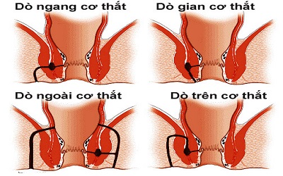 Không có ảnh